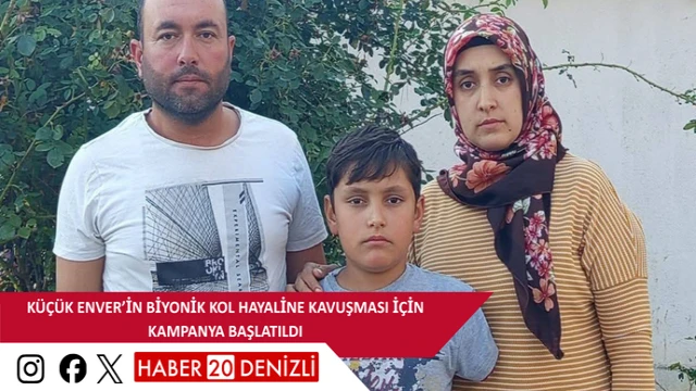 Küçük Enver’in biyonik kol hayaline kavuşması için kampanya başlatıldı