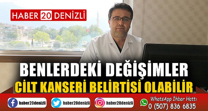 Benlerdeki değişimler cilt kanseri belirtisi olabilir