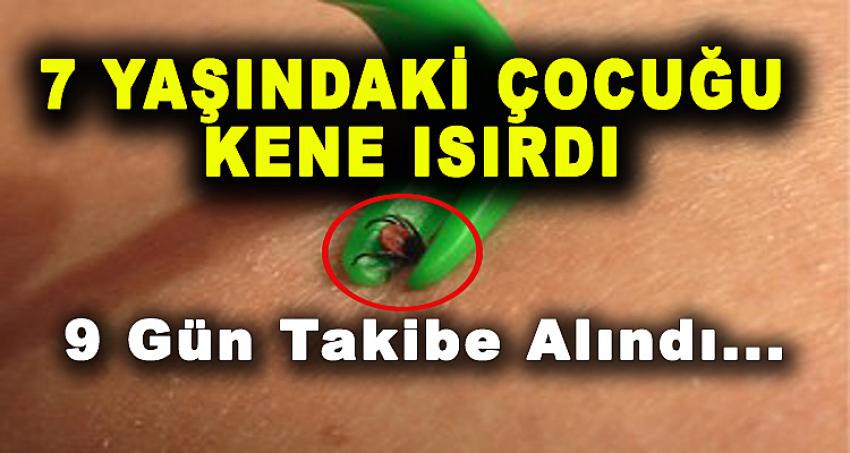 7 YAŞINDAKİ ÇOCUĞU KENE ISIRDI