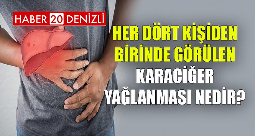 HER DÖRT KİŞİDEN BİRİNDE GÖRÜLEN KARACİĞER YAĞLANMASI NEDİR?