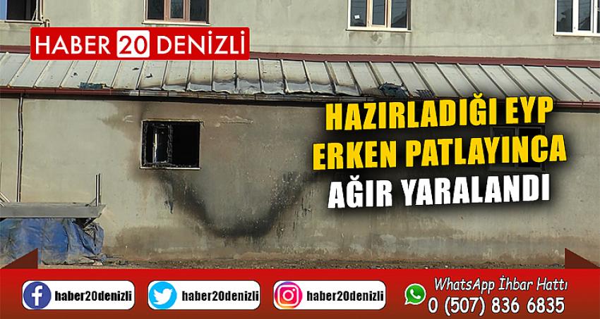 Hazırladığı EYP erken patlayınca ağır yaralandı