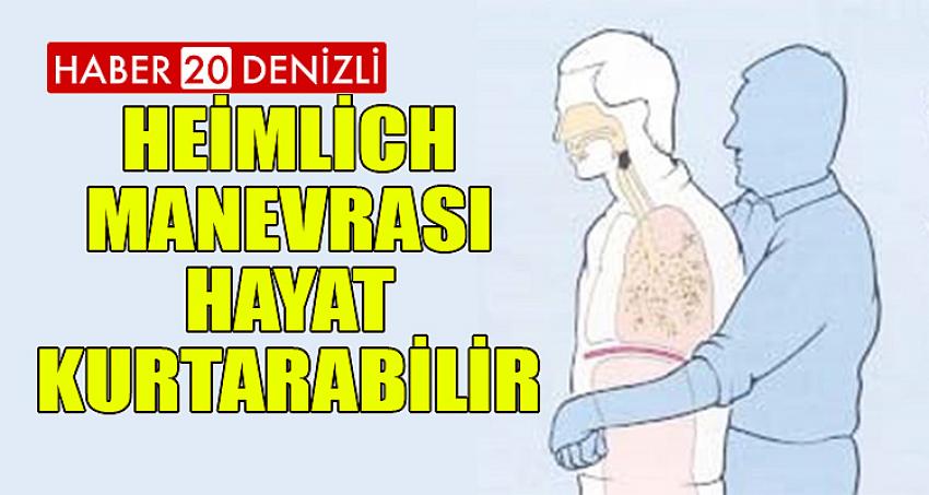 HEIMLICH MANEVRASI HAYAT KURTARABİLİR