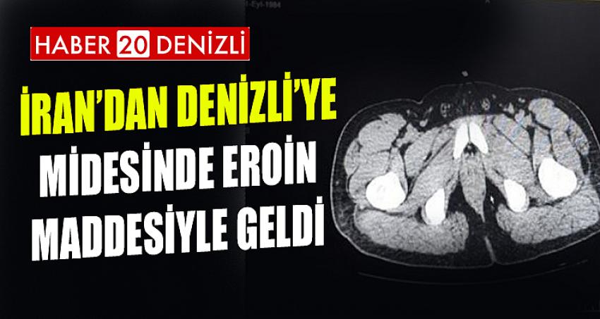 İRAN'DAN DENİZLİ'YE MİDESİNDE EROİN MADDESİYLE GELDİ