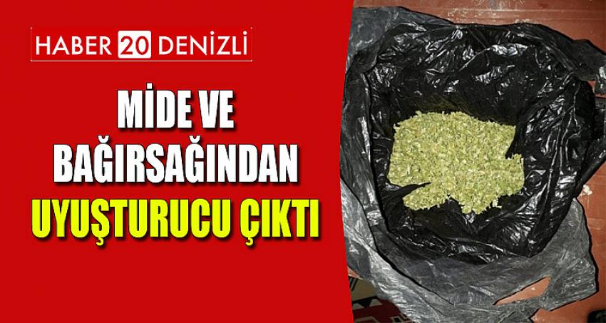 MİDE VE BAĞIRSAĞINDAN UYUŞTURUCU ÇIKTI