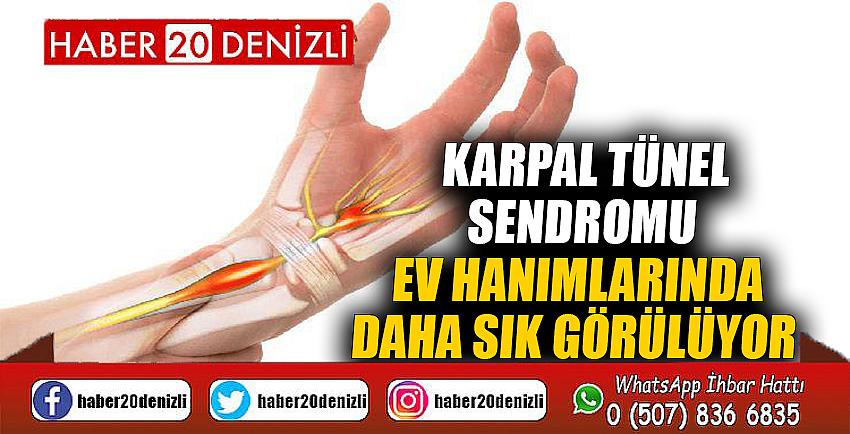 Karpal Tünel sendromu ev hanımlarında daha sık görülüyor