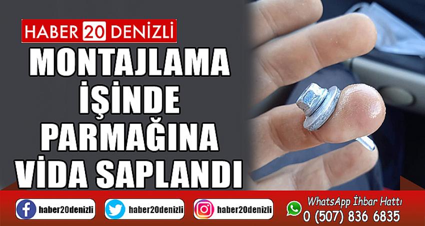 Montajlama İşinde Parmağına Vida Saplandı