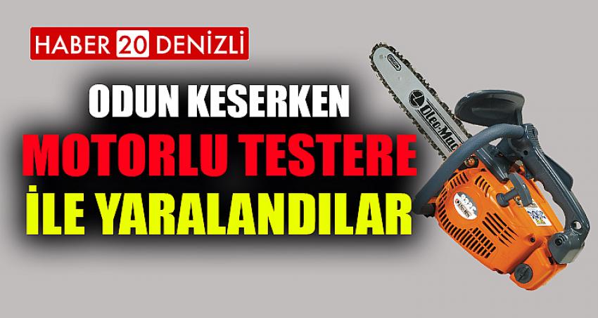 ODUN KESERKEN MOTORLU TESTERE İLE YARALANDILAR