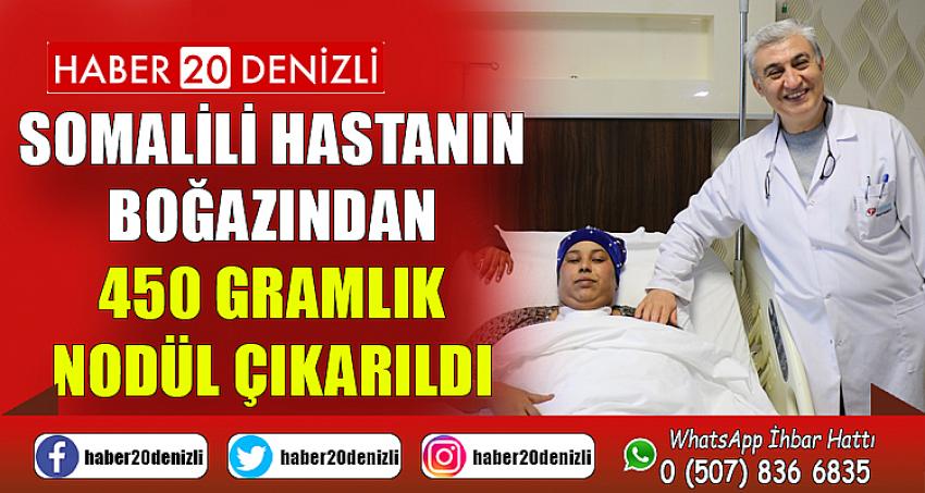 Somalili hastanın boğazından 450 gramlık nodül çıkarıldı